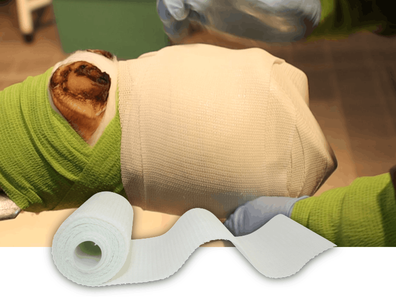 REDO-CAST Stützverband