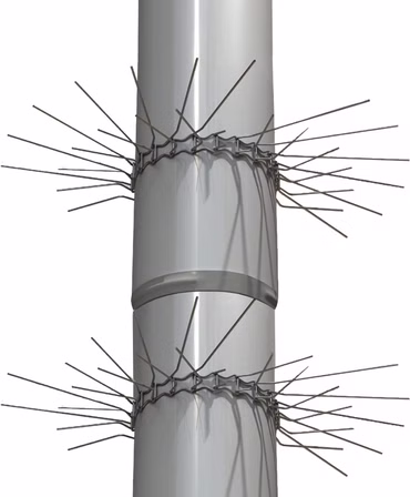 Marderabwehrgürtel für Fallrohre Ø 100mm - 2er Set Marderschutzgürtel Edelstahl Rostfrei - Profi Marderschutz Fallrohr