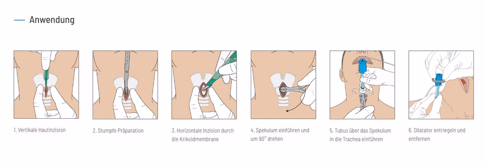 VBM Surgicric Set für die chirurgische Koniotomie Surgicric II