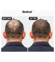 Biotinol Haarserum für dickeres kräftigeres Haar gegen Haarausfall Klinisch getestete Minoxidil-Alternative Haar-Pflege Tierversuchsfrei 30 ml Schwarz/Weiß
