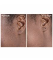 15er Sparpack bondiblades Derma Razor Dermaplaning-Rasierer zur Entfernung von Flaumhaaren nachhaltige Gesichtsrasierer Rosa