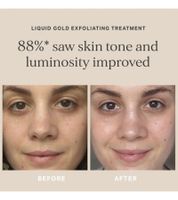 3-Pack ALPHA-H Liquid Gold Peeling Treatment with Glycolic Acid Cosmetic Skincare Radiant Complexion Natural Skin Renewal Skin Firming 50ml